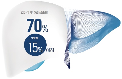 [암치료의 새 시대를 열다] 간암 정복을 위한 다양한 치료법