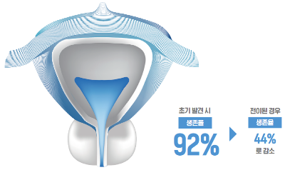 [100세 시대, 건강이 행복을 좌우한다] 중년남성 위협하는 전립선암, 조기발견하면 생존율 높다
