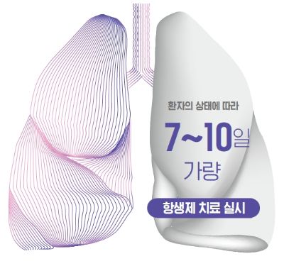 [겨울철 급성질환] 사망률 높은 폐렴의 진단과 치료, ‘폐렴 치료 잘 하는’ 한양대의료원이 나선다
