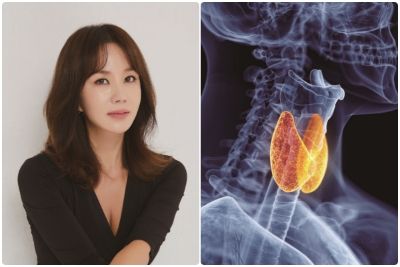음반과 연기 모두 잡은 한국의 마돈나가 극복한 질병은? 가수 겸 배우 엄정화와 갑상선암