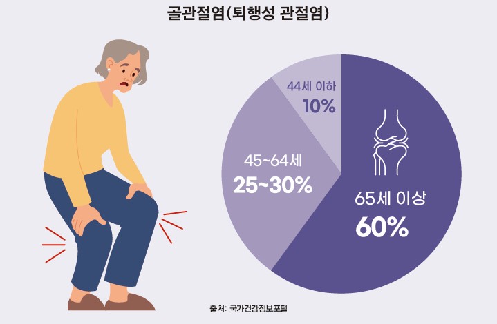 골관절염(퇴행성관절염) / 65세 이상 60%